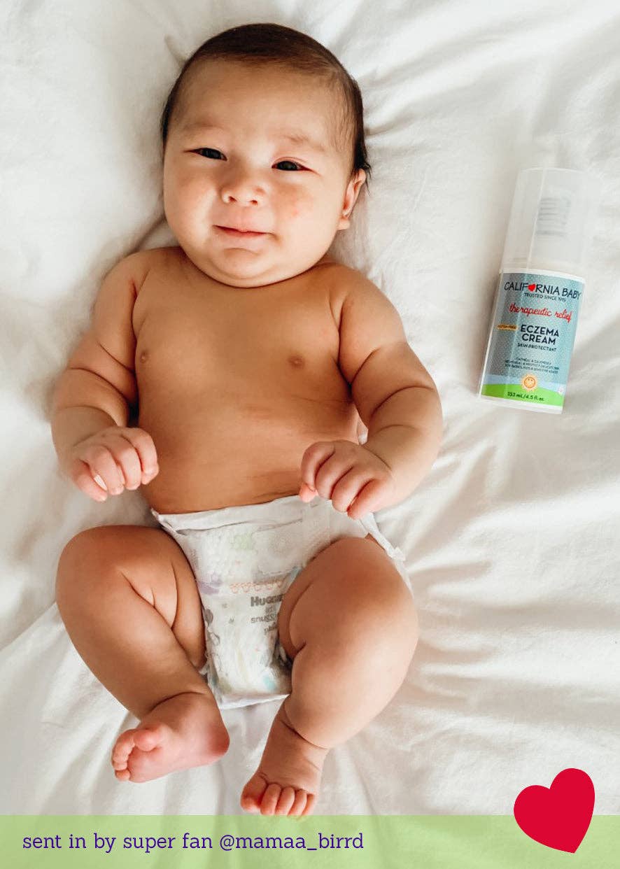 Eczema Cream: 2oz/57g