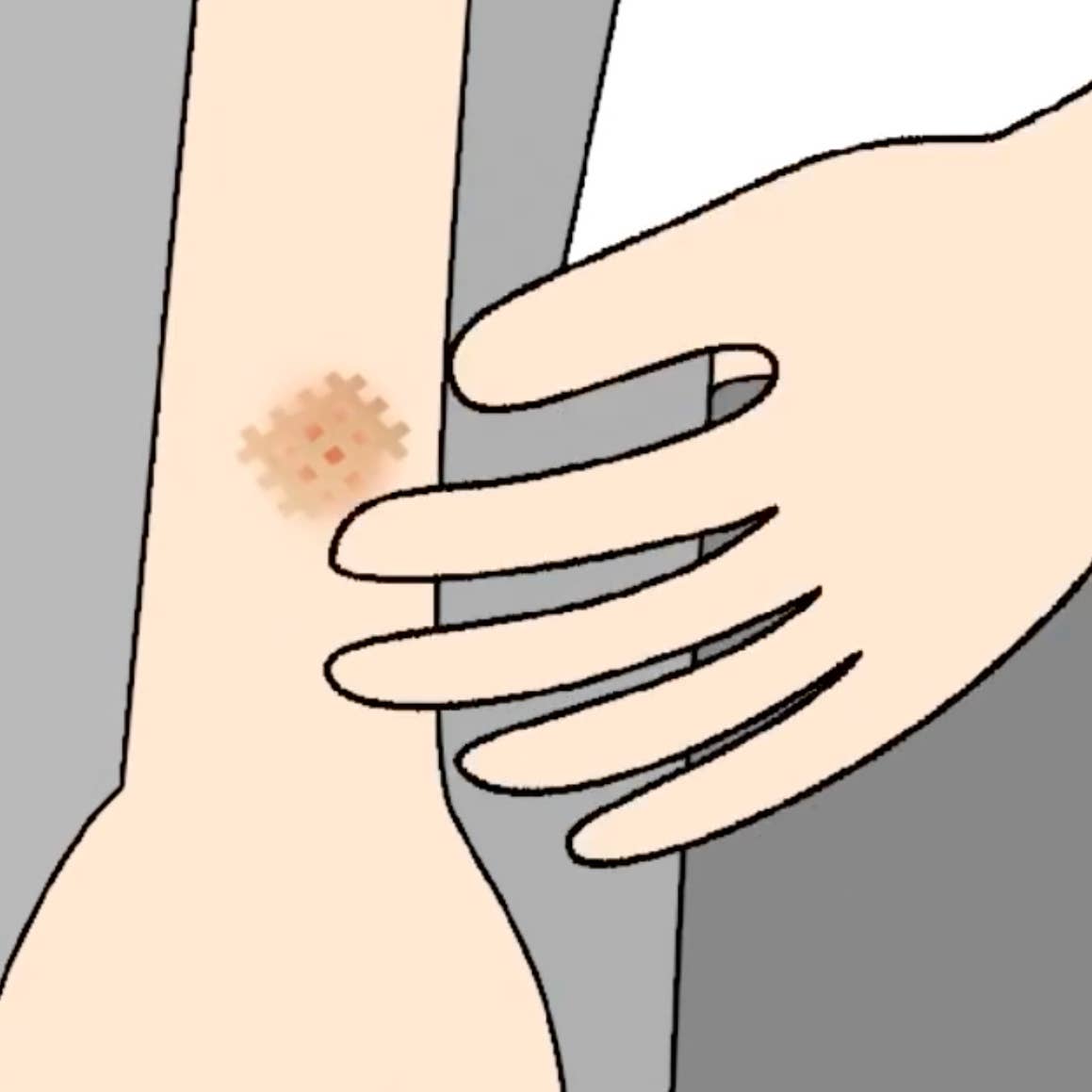 Moskinto 42ct: The Original Itch Relief Patch